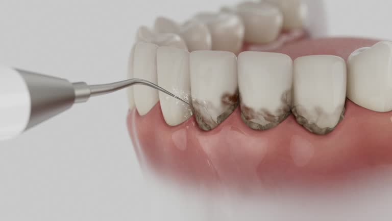 Reliable Dental contractor in Union Parish County, LA by Dentist Open Now